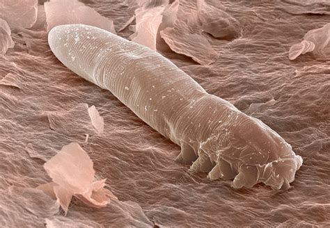 Eyelash mite, SEM - Stock Image - Z445/0314 - Science Photo Library