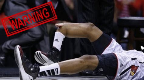 WORST NBA Injuries! *WARNING* - YouTube