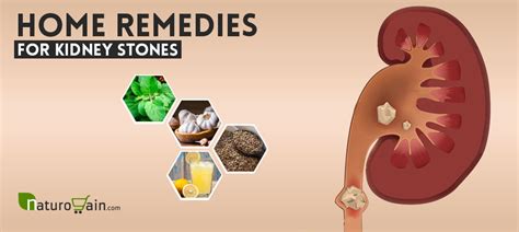 8 Best Home Remedies for Kidney Stones to Improve Kidney Function