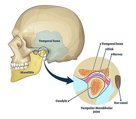 What Are The Causes Of TMJ Related Headaches? - OdontoVida