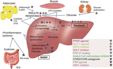 New Drugs on the Block—Emerging Treatments for Nonalcoholic Steatohepatitis