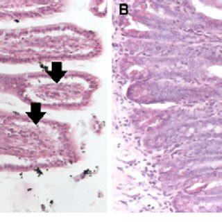 Histology of representative tissue specimens of the terminal ileum... | Download Scientific Diagram