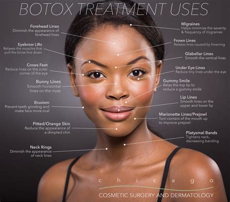 The Best Botox Injection Sites Face Diagram 2022 - Bigmantova