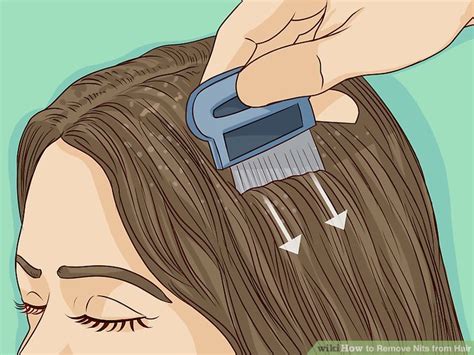 4 Ways to Remove Nits from Hair - wikiHow