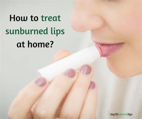 How to treat sunburn lips at home - fast remedy! - Top10 Natural Tips