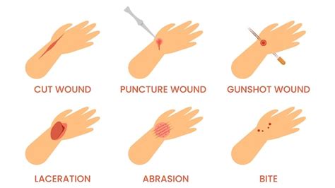 Page 5 | Wound healing Vectors & Illustrations for Free Download | Freepik