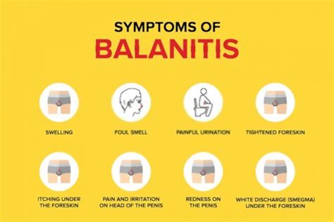 Balanitis Won't Go Away: Is It True? Check This Ultimate Review 2021