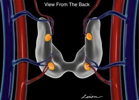 Parathyroid Anatomy image 1 - Hyperparathyroidism Surgery - Dr. Babak ...