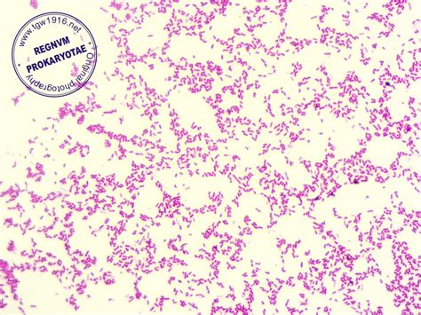 Pseudomonas Aeruginosa Gram Stain