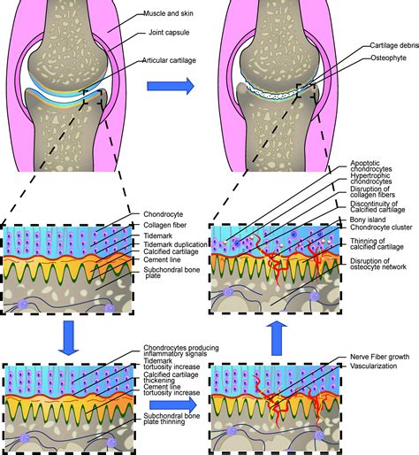 Frontiers | Macro, Micro, and Molecular. Changes of the Osteochondral Interface in ...