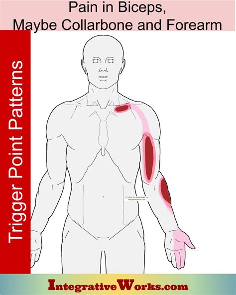 Pain Along the Biceps, Maybe Collar Bone & Forearm - Integrative Works