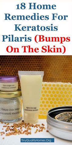 Get Rid Of Thick and Crusty Age Spots and Skin Barnacles | solutions ...