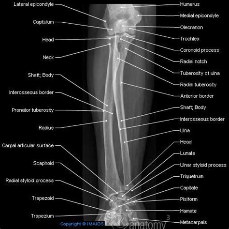 anatomy of radiograph of upper limb | ANATOMY: ANATOMY OF THE UPPER EXTREMITY IN STANDARD ...