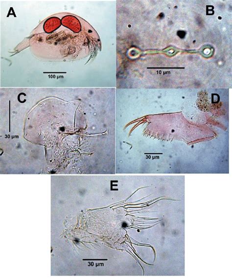 Cladocerans from a temporary pond, La Guajira. Ovalona cf. glabra. A ...