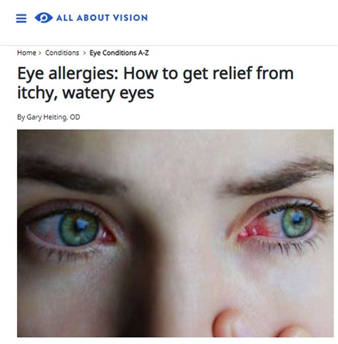 Eye Allergies: How To Get Relief From Itchy, Watery Eyes