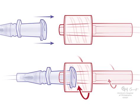 Managing Luer Connections - Anesthesia Patient Safety Foundation