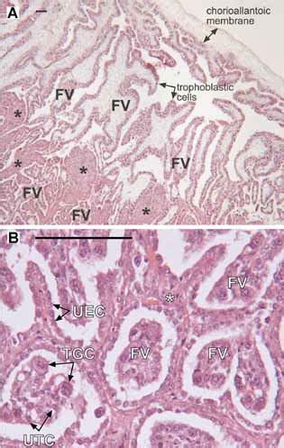 Histology of a day-140 bovine placentome. Formalin-fixed, paraffin... | Download Scientific Diagram