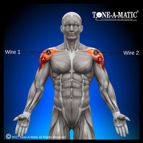 Electrode Placement for Electric Stimulation Charts – Tone-A-Matic
