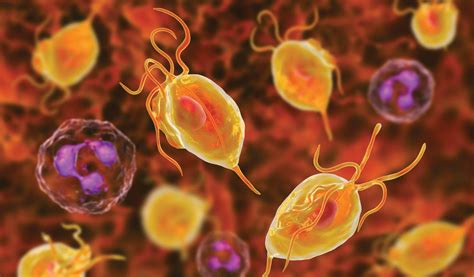 Trichomoniasis - Clinical Lab Products