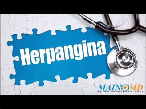 Herpangina ¦ Treatment and Symptoms - YouTube