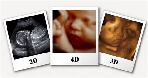 4d Pregnancy Scan - Diagnostics Centre Habra | Diagnostics Centre ...