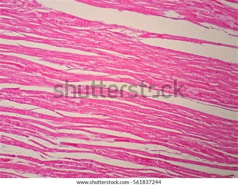 Histology Human Cardiac Muscle Under Microscope Stock Photo (Edit Now) 561837244