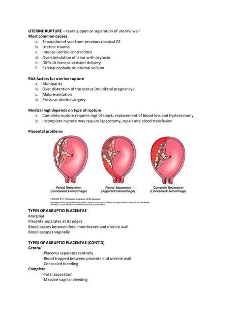 Uterine Rupture