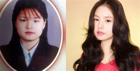 More Korean Actresses Plastic Surgery Before After Pictures – Those Who ...