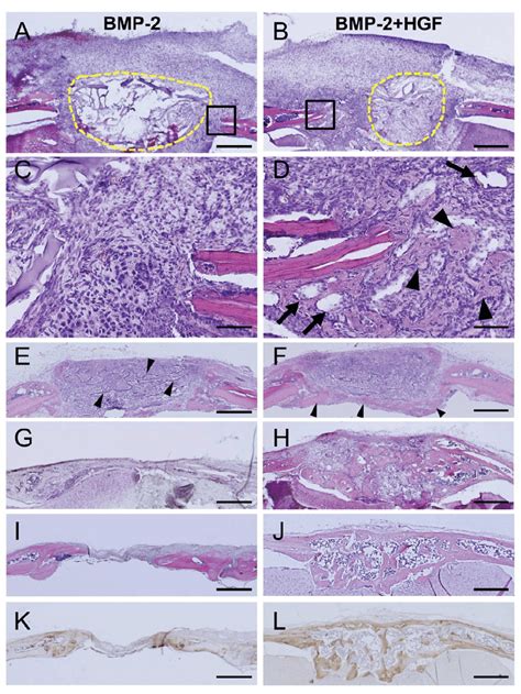 Calvarial healing by histology. Serial sections throughout the defect ...