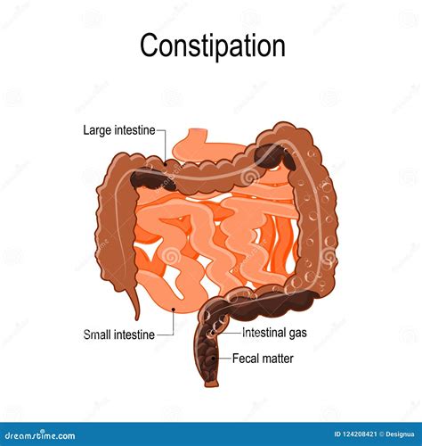 Constipation Cartoons, Illustrations & Vector Stock Images - 7772 ...