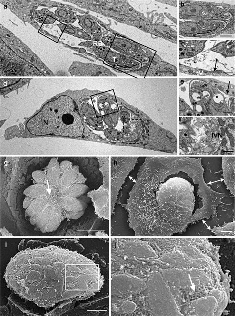 Ultrastructure of the formation of cyst-like structures of tachyzoites... | Download Scientific ...