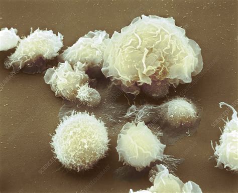 Monocyte white blood cells, SEM - Stock Image - C021/5399 - Science Photo Library