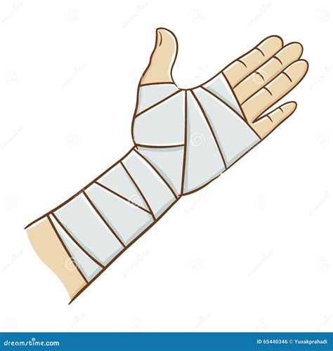 Injured Hand Wrapped In Elastic Bandage Vector Illustration Stock ...