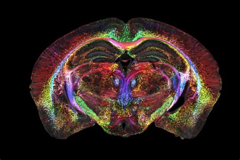 Scans that are 64 million times clearer give a new look at the brain