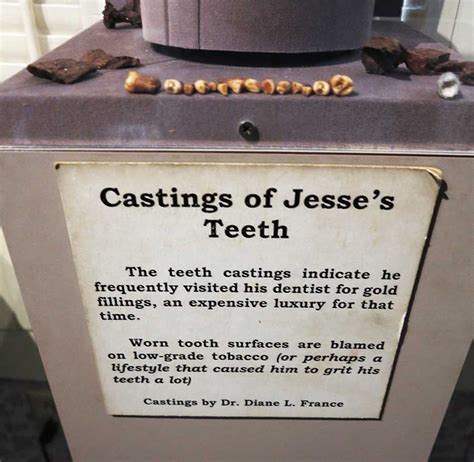 Jesse James Home Museum, St Joseph, MO – Teeth | Arthur Taussig