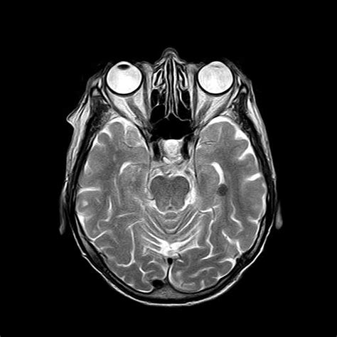 Brain MRI | Two Views