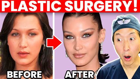 Plastic Surgeon Reacts to BELLA HADID Cosmetic Surgery Transformation ...