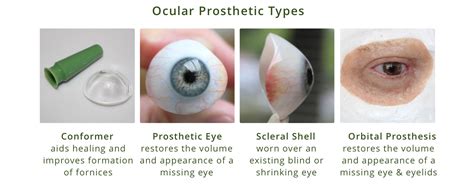 Eye Conditions and Solutions with Northwest Eye Design