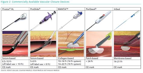 Large-bore Vascular Closure: New Devices and Techniques | ICR Journal