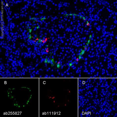 F4/80抗体[F4/80] - Macrophage Marker| Abcam中文官网