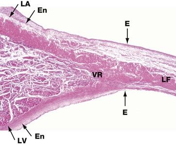 Heart Valve Histology