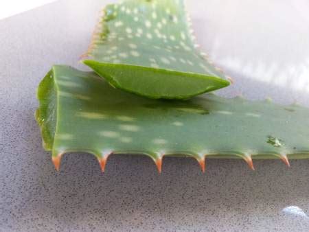 Aloe Vera for Scalp Psoriasis - 5 Awesome Methods to Try