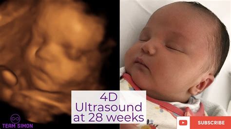 4d Ultrasound at 28 weeks | Baby Journey | THE SIMON FAMILY - YouTube