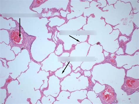 Lung Alveoli Histology Flashcards Quizlet | The Best Porn Website