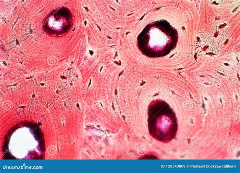 Histology of Human Compact Bone Tissue Under Microscope View for Stock ...