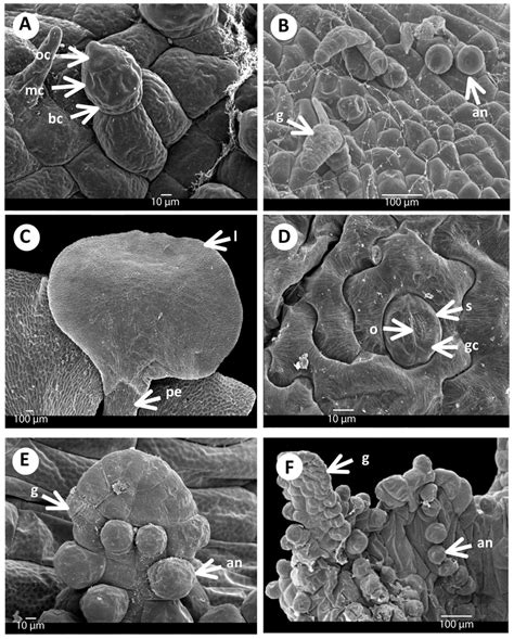 Gametangia and first leaf of Acrostichum: A) Antheridia of A.... | Download Scientific Diagram