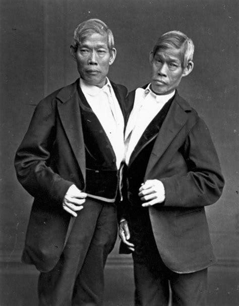 Surprising Facts About The First Ever Siamese Twins