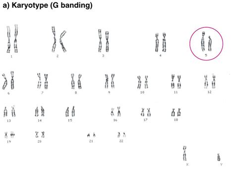 Euploid karyotypes