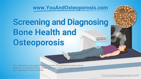 Osteoporosis Diagnosis