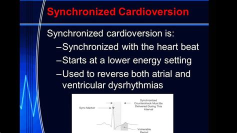 Pacemakers, Defibrillators, Cardioversion - YouTube